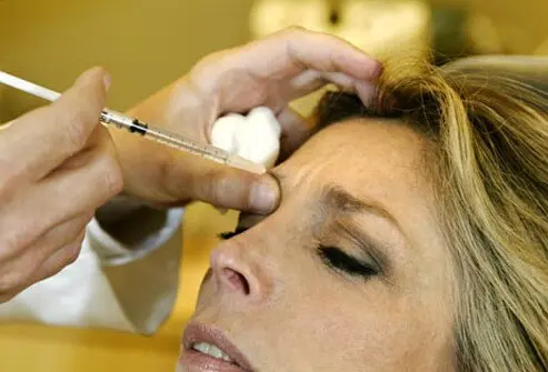 A woman receives a Botox injection to her forehead.