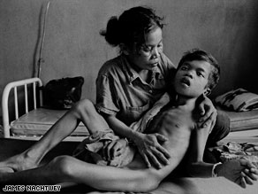 A mother comforts her young son who is suffering from TB meningitis.