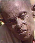 Ethiopian man too weak to brush flies from his face, October 1984