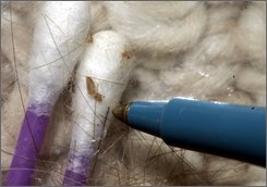  A woman who claims to be suffering from a rare infection called Morgellons uses a pen to point to items on a cotton swab that she believes are the bugs connected to the condition, at her Roseville, Calif., home, in this 2006 file photo. The U.S. Centers for Disease Control and Prevention is paying California-based health care giant Kaiser Permanente $338,000 to test and interview patients suffering from Morgellons' bizarre symptoms. (AP Photo/Rich Pedroncelli, FILE)